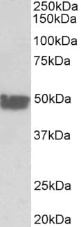PathPlus™ KRT20 / CK20 / Cytokeratin 20 Antibody (aa48-60)