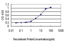 IHC-plus™ Monoclonal Mouse anti-Human CDH18 / Ey-Cadherin Antibody (clone 6F7, IHC, WB)