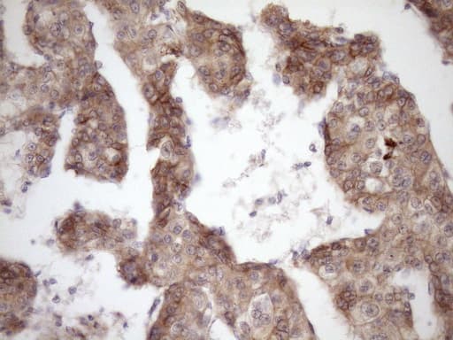 CTNNB1 / Beta Catenin Antibody (aa29-118, clone OTI2F10)