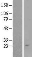 RNF152 Protein (Over-Expression Lysate Myc-DDK (Flag))