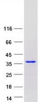 Human SETBP1 / SEB Protein (Recombinant Myc-DDK (Flag))