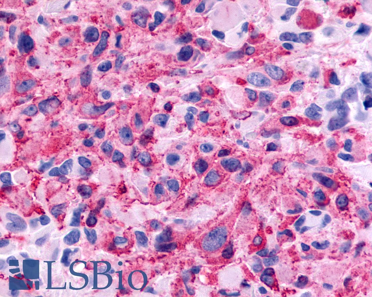 PathPlus™ GALR2 / Galanin Receptor 2 Antibody (C-Terminus)