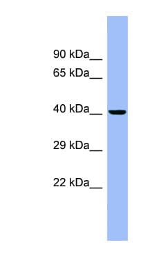 CD66c / CEACAM6 Antibody (aa35-84)