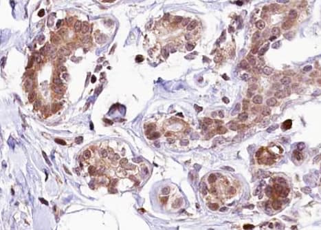 ER Alpha / Estrogen Receptor Antibody (phospho-Ser118)