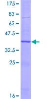 Human LTC4S / LTC4 Synthase Protein (Recombinant GST)