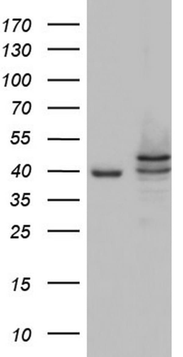 CSNK1E / CK1 Epsilon Antibody (aa153-416, clone OTI5D4)