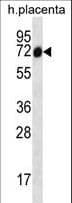 Polyclonal Rabbit anti-Human SCLT1 Antibody (aa577-605, IHC, WB)