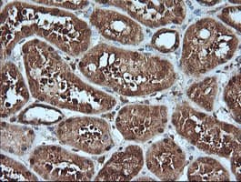 MLANA / Melan-A Antibody (clone OTI3A2)