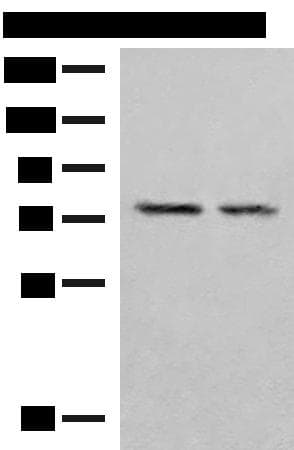 Polyclonal Rabbit anti-Human PDIA4 / ERP72 Antibody (IHC, WB)