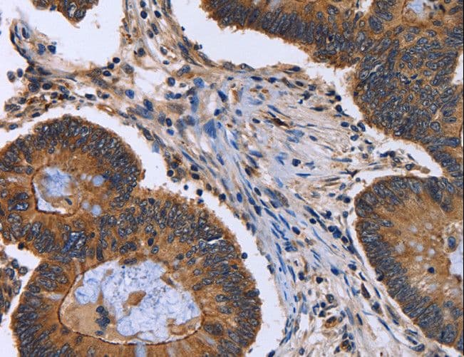 FRK Antibody