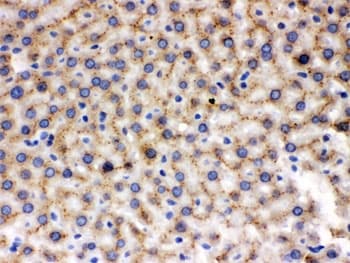 Polyclonal Rabbit anti-Mouse MMP9 / Gelatinase B Antibody (IHC, WB)