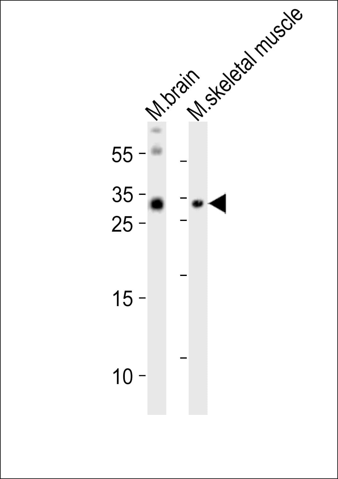 OLIG3 Antibody (aa15-48)