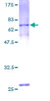 Human FIBP Protein (Recombinant GST)