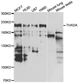 Polyclonal Rabbit anti-Human THADA Antibody (IHC, IF, WB)