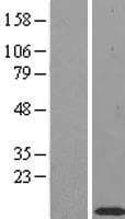 TIMM10 Protein (Over-Expression Lysate Myc-DDK (Flag))