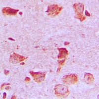 NDUFA8 Antibody (Internal)