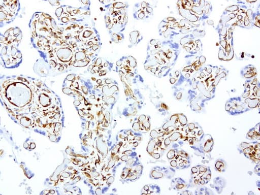 Monoclonal Mouse anti-Human Vimentin Antibody (clone UMAB159, Carrier-free, aa210-466, IHC, IF, WB)