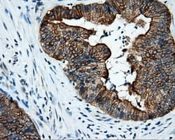 SRR / Serine Racemase Antibody (clone OTI2E3)