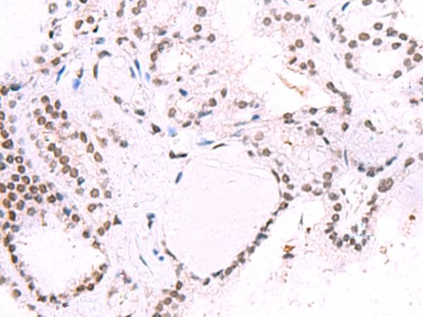 Polyclonal Rabbit anti-Human IRF2BP1 Antibody (IHC)