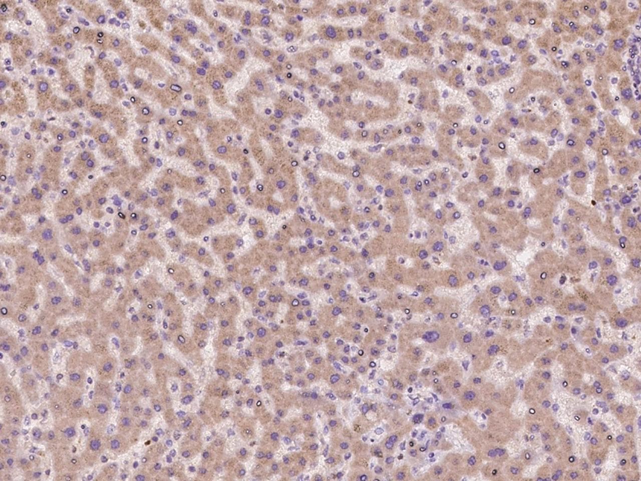 Polyclonal Rabbit anti-Human CNIH1 / CNIH Antibody (IHC)