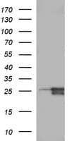 Monoclonal Mouse anti-Human BID Antibody (clone OTI3E6, WB)