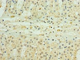 IHC-plus™ PDGF-D Antibody (aa191-370)