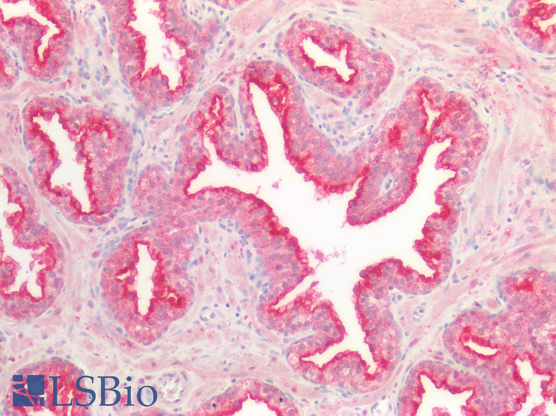 PathPlus™ Polyclonal Rabbit anti-Human MLPH / Melanophilin Antibody (IHC)