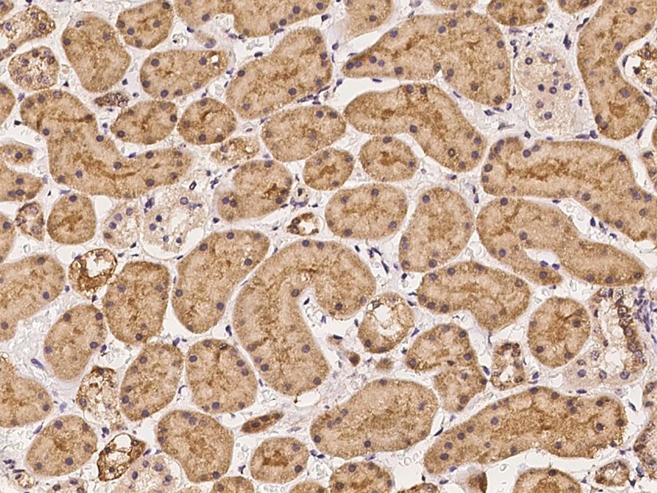 ENDOD1 Antibody