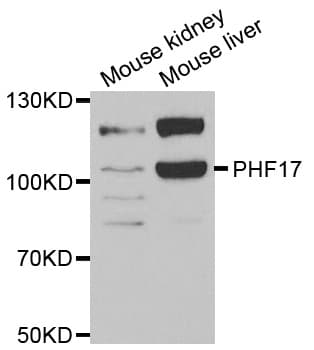 Polyclonal Rabbit anti-Human JADE1 / PHF17 Antibody (IF, WB)