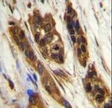 SNRNP27 Antibody (aa69-98)
