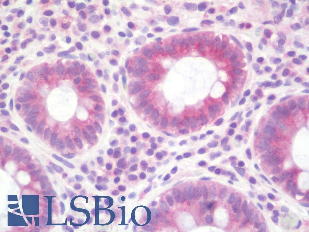 IHC-plus™ Polyclonal Rabbit anti-Human ARFIP1 Antibody (aa271-320, IHC, IF, WB)