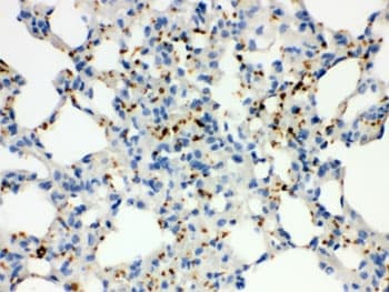 Polyclonal Rabbit anti-Human ITGA2B / CD41 Antibody (IHC, WB)