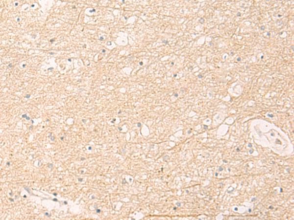Polyclonal Rabbit anti-Human IKBKAP / IKAP Antibody (IHC)
