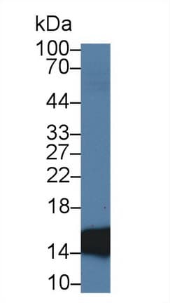 I-FABP / FABP2 Antibody (aa2-132)