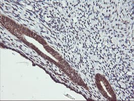 MAP2K2 / MKK2 / MEK2 Antibody (clone OTI1A2)