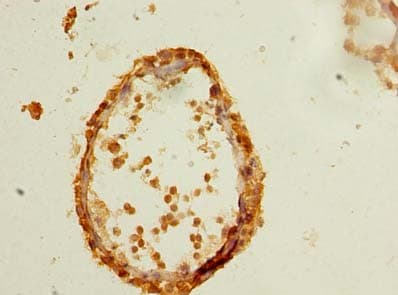 Polyclonal Rabbit anti-Human CFAP61 / C20orf26 Antibody (IHC)