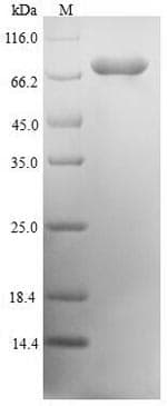 Human SMIF / DCP1A Protein (Recombinant 6His, N-terminus)