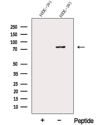 DDHD2 Antibody