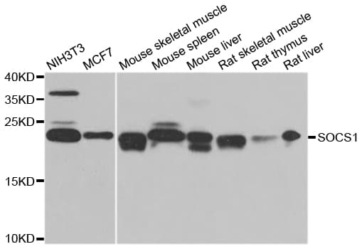 SOCS1 Antibody