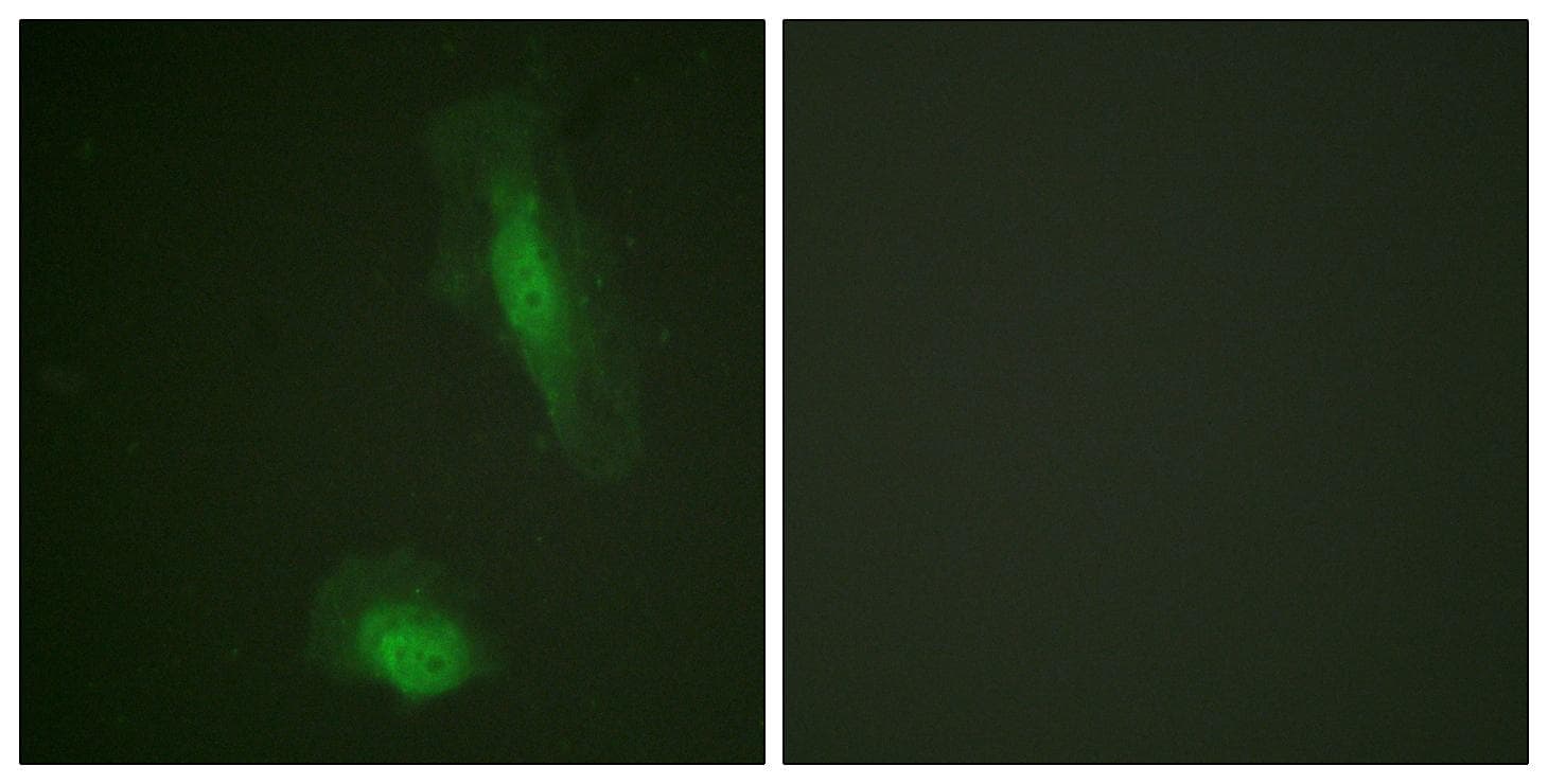 AKT1 Antibody (p129)