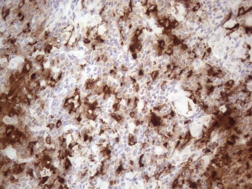 Monoclonal Mouse anti-Human GPNMB / Osteoactivin Antibody (clone OTI2F9, Carrier-free, IHC)