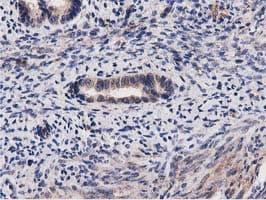 ACOT12 Antibody (clone OTI1A11)