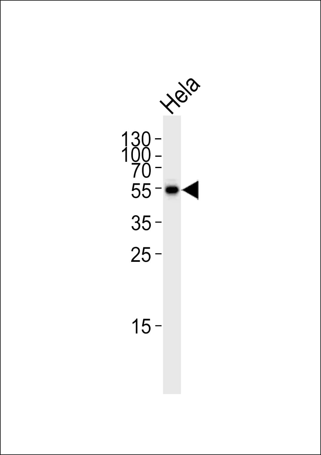 GLS / Glutaminase Antibody (aa516-545)