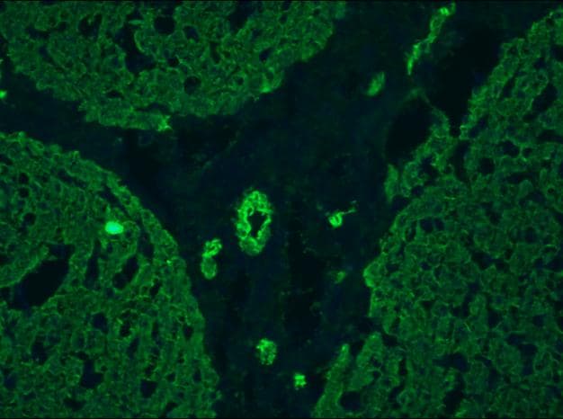 IHC-plus™ Cytokeratin 5+8 Antibody (clone RCK102)