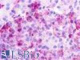IHC-plus™ UTS2R / GPR14 Antibody (Cytoplasmic Domain)