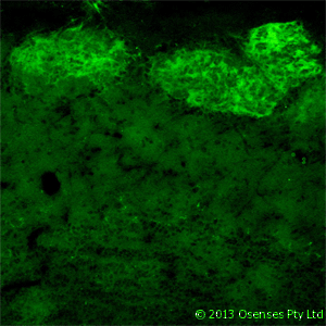 NGFR / CD271 / TNR16 Antibody (clone MC192)