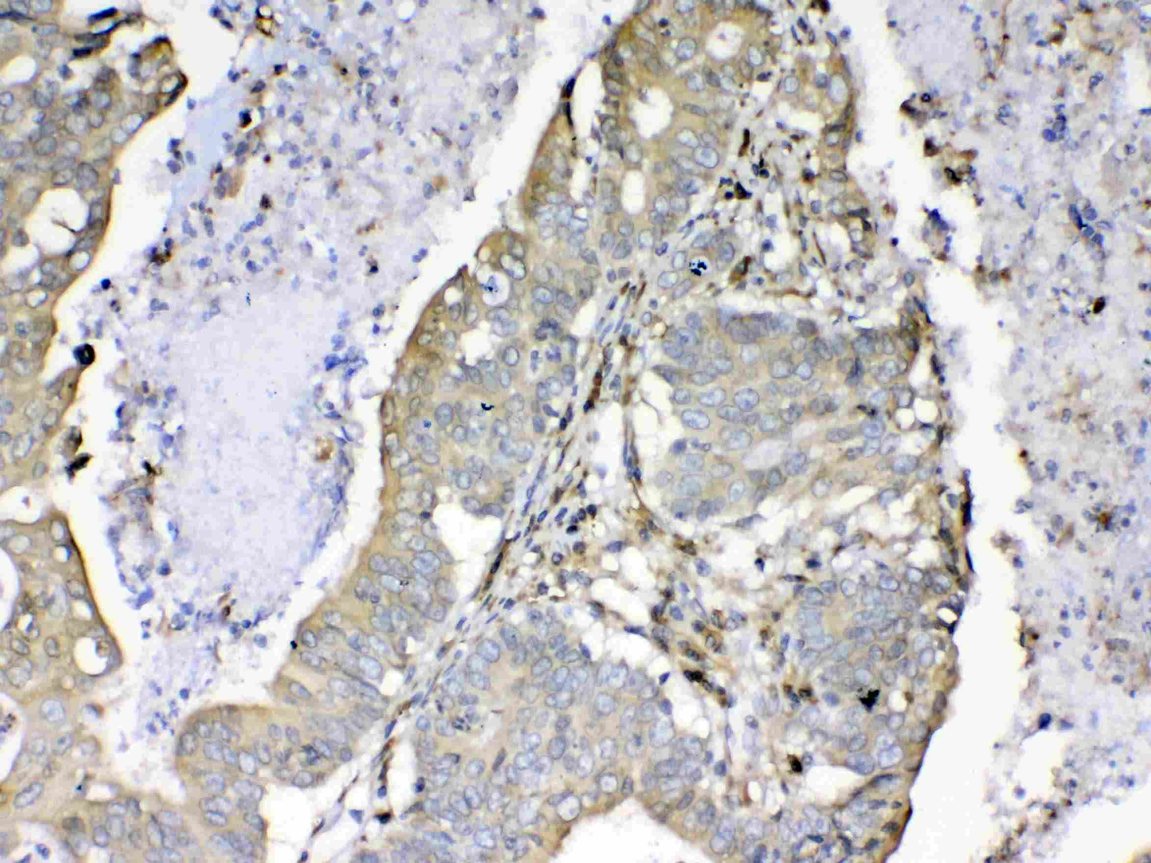 Polyclonal Rabbit anti-Human PPIB / Cyclophilin B Antibody (IHC, WB)