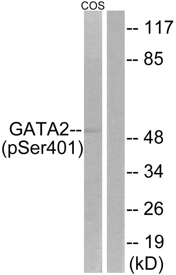 Polyclonal Rabbit anti-Human GATA2 Antibody (phospho-Ser401, WB)