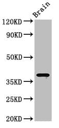 Polyclonal Rabbit anti-Human SIPR2 / S1P2 / EDG5 Antibody (IHC, WB)