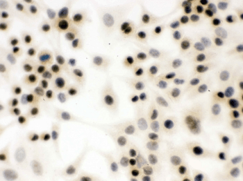 Polyclonal Rabbit anti-Human NBN / Nibrin Antibody (IHC, WB)